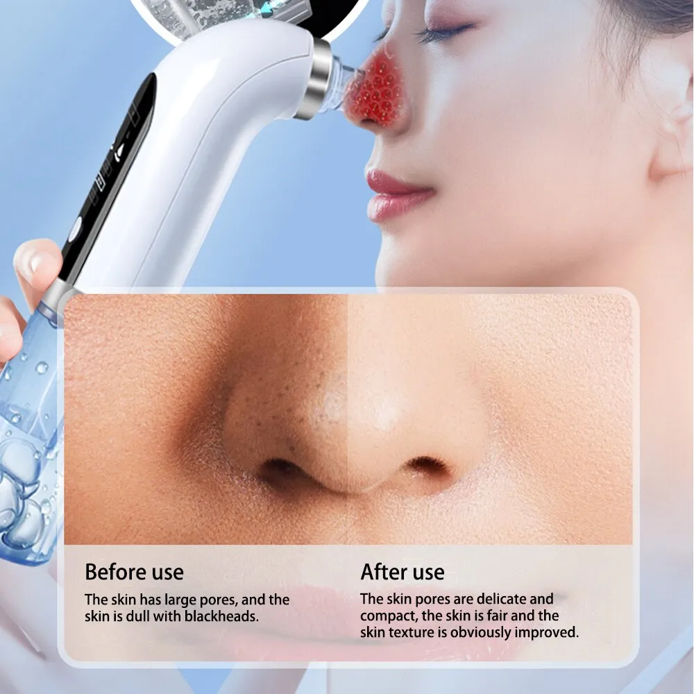 Hydroderm Abrasion
